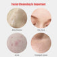 Sonic Silicone Facial Brush – Deep Cleansing & Pore Exfoliator