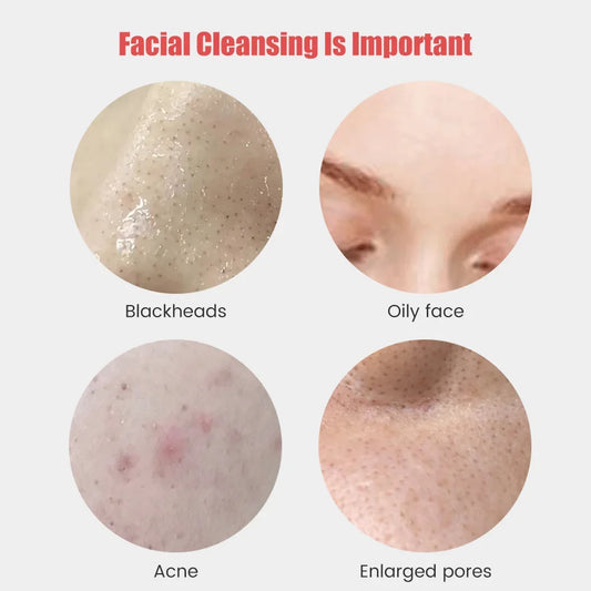 Sonic Silicone Facial Brush – Deep Cleansing & Pore Exfoliator