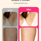 990,000 Flashes IPL Laser Hair Removal – Painless & Permanent