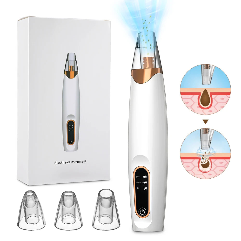 Electric Vacuum Suction Blackhead Remover – Rechargeable Facial Pore Cleaner