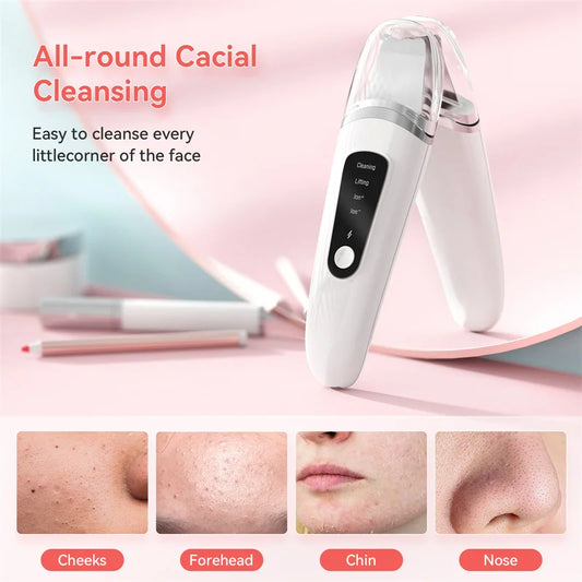 Ultrasonic Skin Scrubber – Facial Exfoliator & Blackhead Remover